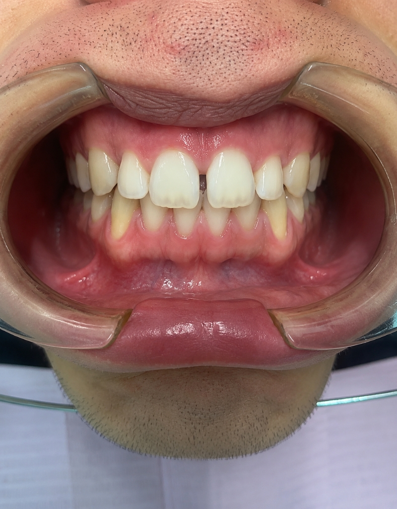 sara saltarelli studio dentistico piazza bologna roma dentista ortodonzia apparecchio