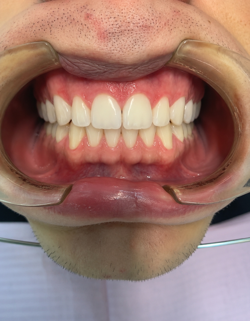 sara saltarelli studio dentistico piazza bologna roma dentista ortodonzia
